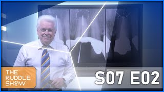 S07 E02  Patient Protocol amp Post Removal CBCT amp the Post Removal System [upl. by Fredek]