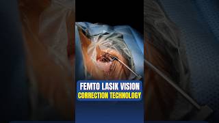 Live Femto Lasik Vision Correction Surgery [upl. by Bryon]