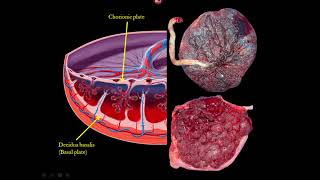 The Placenta and Umbilical Cord Ultrasound Video Lecture [upl. by Acilegna728]