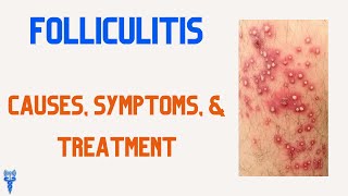 FOLLICULITIS Causes Symptoms amp Treatments [upl. by Crowell]