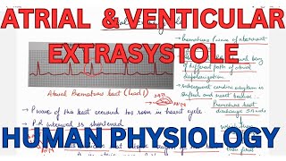 ATRIAL extrasystole Ventricular Extrasystole compensatory pause CVS [upl. by Toomin]