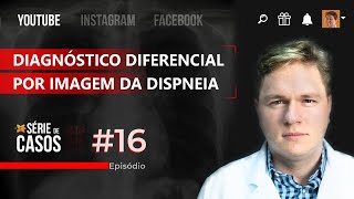 Diagnóstico diferencial por imagem da Dispneia  Série de Casos 16 [upl. by Adym]