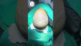 Hair transplant clinic Bangladesh Call 01733510402 [upl. by Nevek]