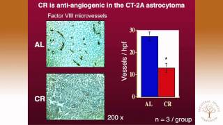 AHS12 Thomas Seyfried PhD —Targeting Energy Metabolism in Brain Cancer [upl. by Maynord32]