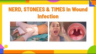 NERD STONEES amp TIMES in wound infection  wound bioburden PhysiotherapyKnowledge [upl. by Emorej151]