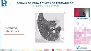 Afectarea pulmonara in vasculitele sistemice  Cristina Pamfil [upl. by Argella]