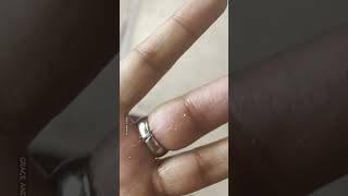 Girl Gets Ring Stuck On Finger 😱💍 [upl. by Plafker64]