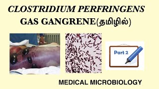 Clostridium perfringens Part 2  Gas gangrene  Pathogenesis  Lab diagnosis  Treatment  Tamil [upl. by Ainig]