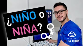 ¿Cómo saber si es NIÑO o NIÑA por ULTRASONIDO [upl. by Adnarym]