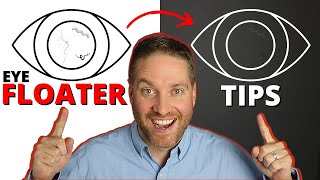 Eye Floaters Help  5 Natural Life Hack Remedies For Adapting To Eye Floaters [upl. by Ahtanamas]