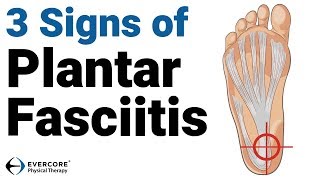 Plantar Fasciitis 3 signs you may have plantar fasciitis [upl. by Ainelec]