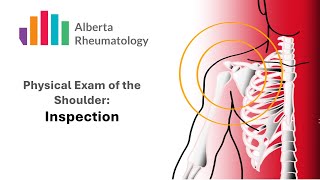 Rheumatology Shoulder Physical Exam Part 2 Inspection [upl. by Odlabu865]