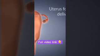 doctor gynecologist uterus [upl. by Cooperman]