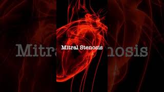 Normal vs Mitral Stenosis [upl. by Ellan]