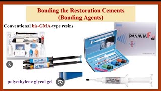 Bonding Steps of ResinBonded FDP بالعربي [upl. by Cash]