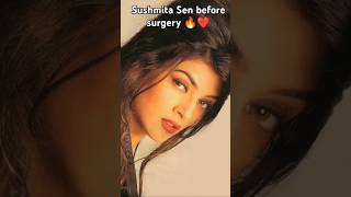 Sushmita Sen before and after ❤️🔥 bollywood hindisong sushmitasen [upl. by Ratib]