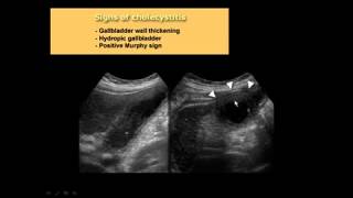 05 ERIC Abdomen Non Trauma  Emergency Imaging [upl. by Rodman]