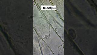 Plasmolysis and Osmosis biology gcse [upl. by Cammi]