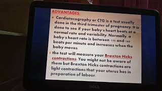 Modalities of diagnosis during pregnancy [upl. by Turpin]