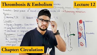 Thrombosis amp Embolism Cardiovascular Disorder  Chapter circulation  Video  12 [upl. by Eirahcaz]