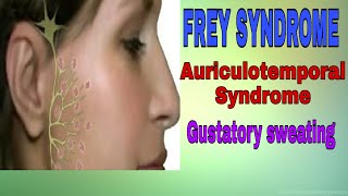 Frey Syndrome  Auriculotemporal Syndrome  Gustatory Sweating  dental Maestro  DrJyoti Agarwal [upl. by Edgerton]