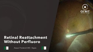 Retinal reattachment without perfluoro [upl. by Abbotsun]