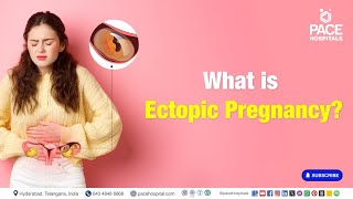 Ectopic Pregnancy Surgery  What is Ectopic Pregnancy  ectopicpregnancy [upl. by Eanod]