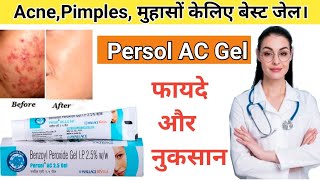 Persol ac gel 25  Benzoyl Peroxide gel 25  Benzoyl Peroxide For Acne  by Drx Pranjali Satpute [upl. by Rostand354]