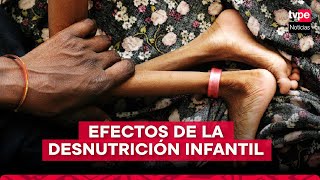 Desnutrición infantil cuáles son las causas y consecuencias de esta problemática en el Perú [upl. by Kennard360]