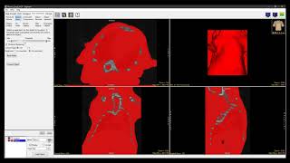 Analyze 150  Segment Using Filter Objects to Improve Segmentation [upl. by Anrapa]