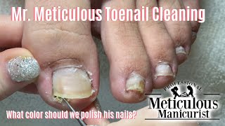 Shortn Sweet  Mr Meticulous Satisfying Impacted Toenail Cleaning [upl. by Lydia]