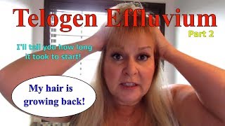 Telogen Effluvium part 2 Regrowth its happening [upl. by Uuge]