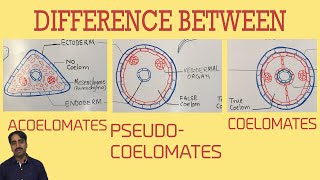 Acoelomates Pseudocoelomates and coelomates  Triploblastic organisation [upl. by Eirb]