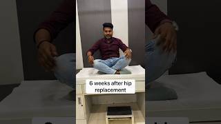 Recovery time in MIS Hip replacement totalhipreplacementsurgery shortsindia [upl. by Haggar]