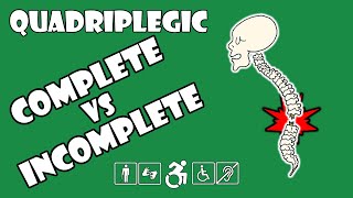 Complete vs Incomplete Spinal Cord Injury Explained  Quadriplegic C5C6C7 [upl. by Mccullough276]