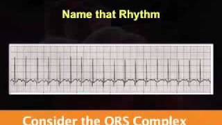 Introduction to EKG Rhythm Interpretation Part 2 [upl. by Swords]