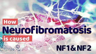 How Neurofibromatosis Type 1 and Type 2 is caused  NF 1 amp NF 2 [upl. by Gamages958]