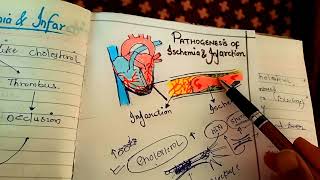 pathogenesis of ischemia and infarction NGMedicals [upl. by Huggins]