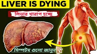 লিভার খারাপের লক্ষণ কি Early Signs of Liver Cirrhosis এই Symptom দেখে বুজবেন লিভার খারাপ হচ্ছে [upl. by Ranip]