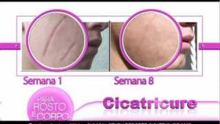 Cicatricure Gel [upl. by Aneba]