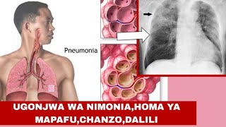 UGONJWA WA NIMONIAHOMA YA MAPAFUCHANZODALILI NA TIBA [upl. by Venola]