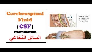 Clinical Chemistry  Cerebro  Spinal Fluid CSF Examination [upl. by Levine]