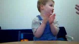 AUTISM  teaching Early Imitation [upl. by Hairam]