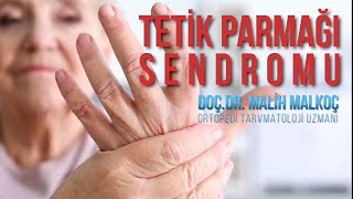 Tetik Parmak Sendromu Trigger Finger Syndrome DoçDr Melih MALKOÇ [upl. by Harrietta]