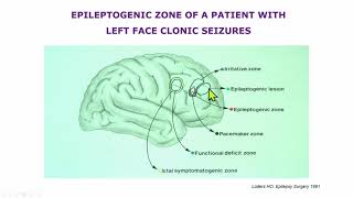 AES 2023 Epilepsy Specialist Symposium  The Frontal Lobe Bermudas Triangle [upl. by Ellasal]