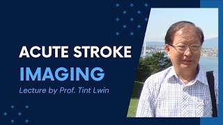 Prof Tint Lwin Acute Stroke Imaging Update [upl. by Anawk]