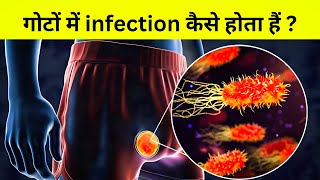 मर्द हो तो ज़रूर देखना  मर्दों के गोटों में infection [upl. by Blaine]