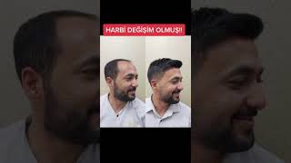 protezsaç değişim saçprotezi barbershop barber [upl. by Niar]