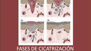 Fases de Cicatrización de las heridas [upl. by Frida690]