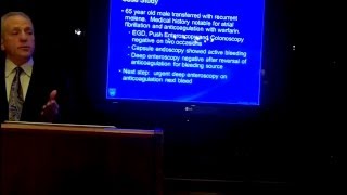 quotObscure Gastrointestinal Bleeding A Guideline Based Reviewquot Dr Jonathan Leighton [upl. by Shara]